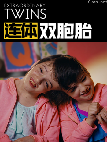 连体双胞胎
